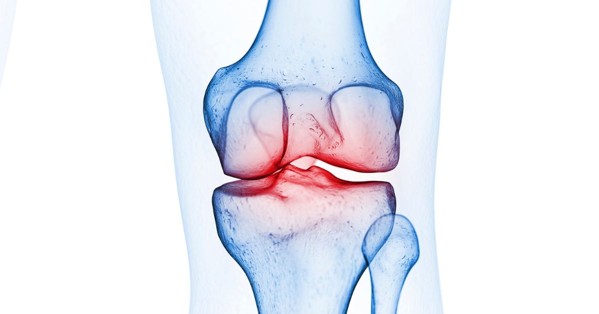 colágeno para artrose no joelho